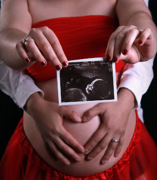 kobieta w ciąży pokazująca zdjęcie usg